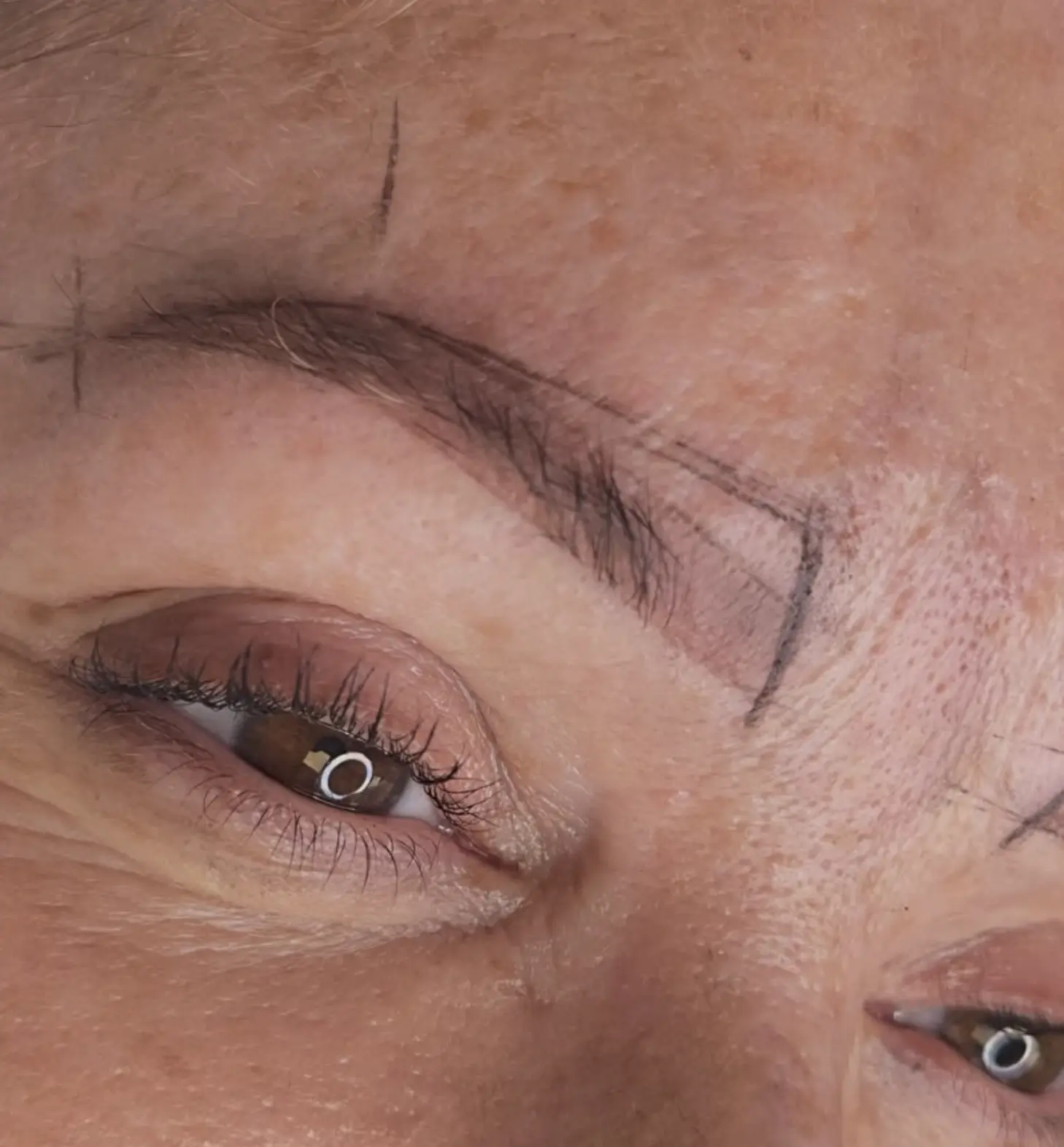 eyebrow tattoo removal