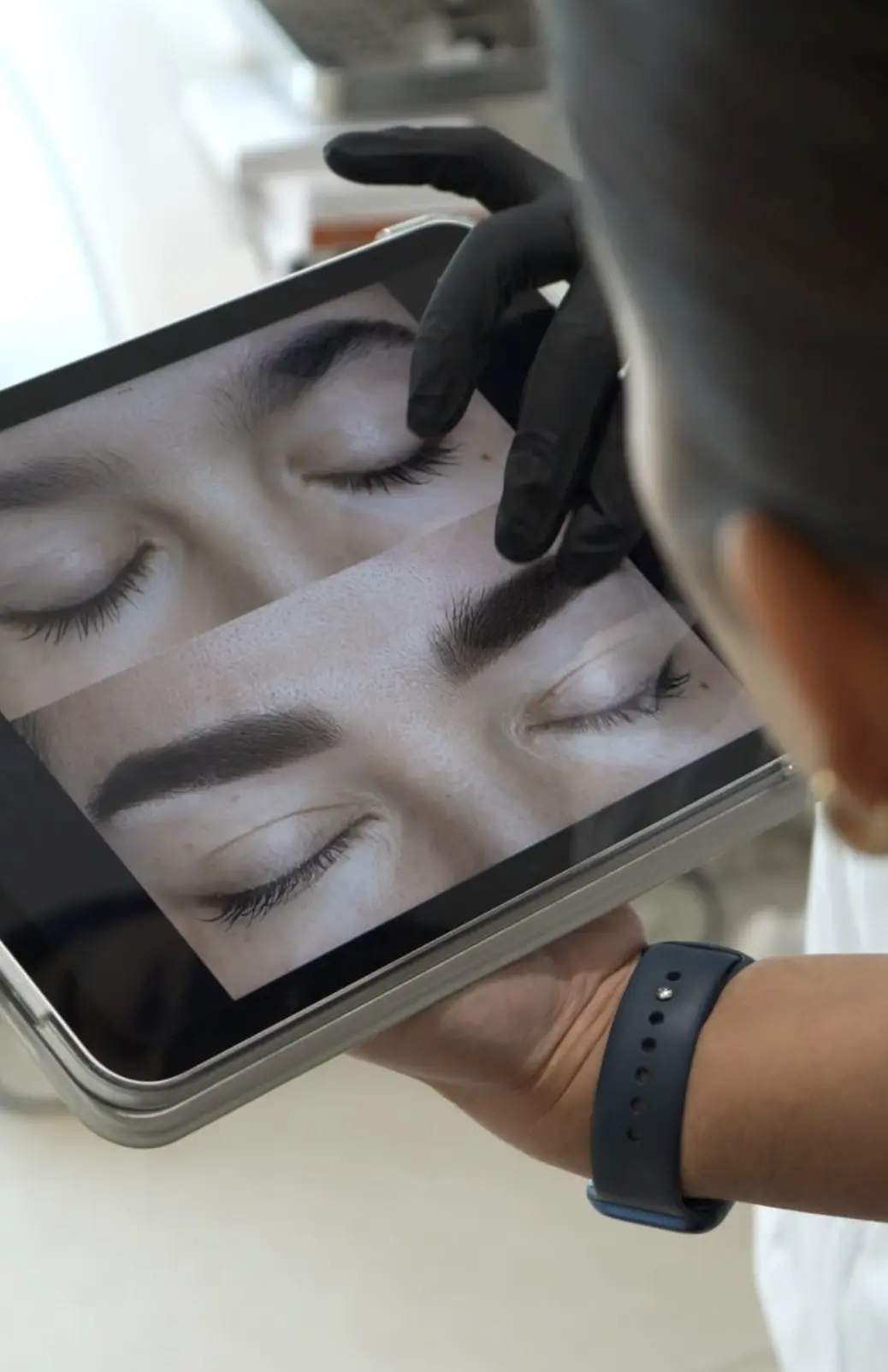 eyebrow tattoo removal brisbane
