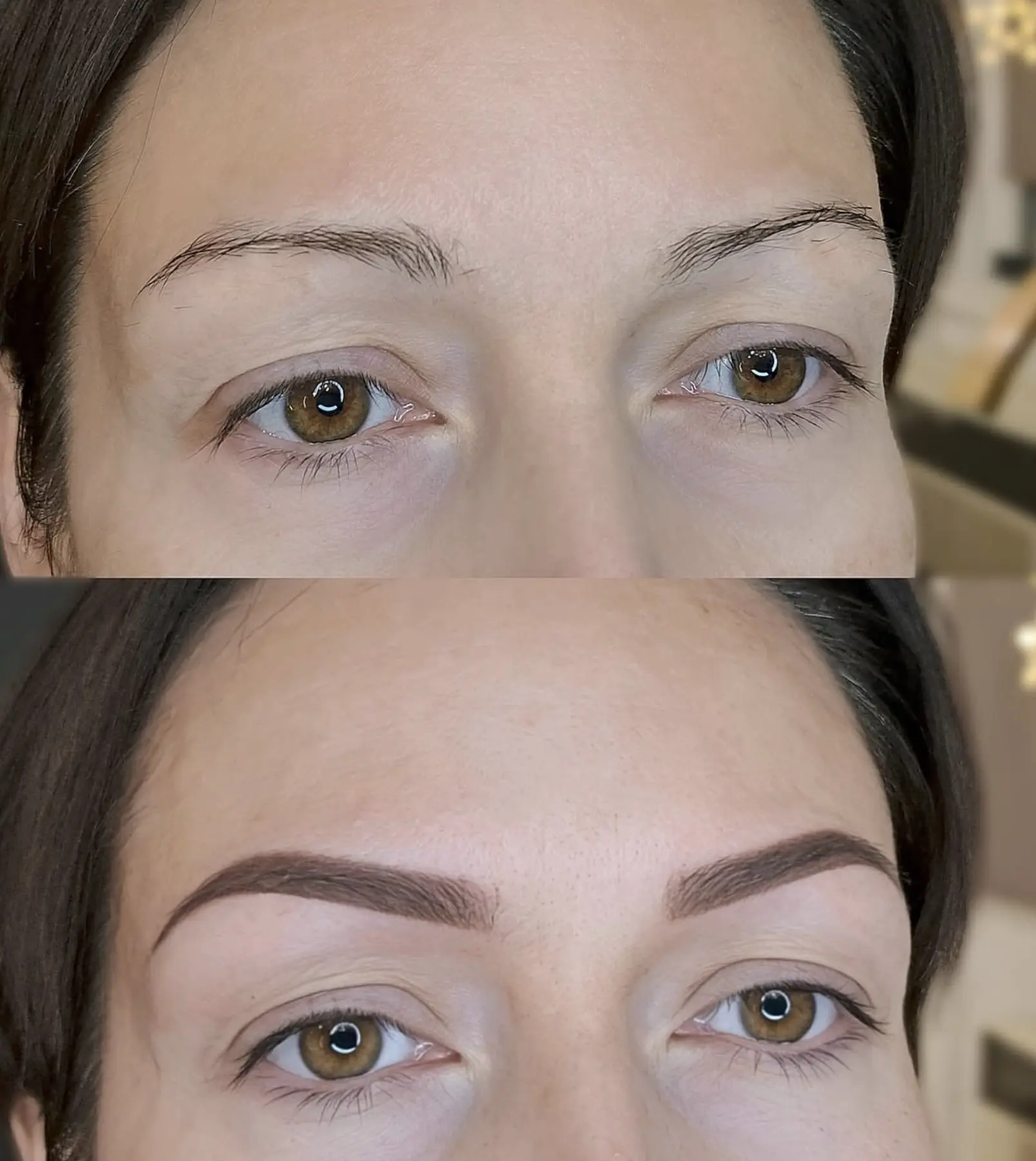 eyebrow tattoo removal melbourne