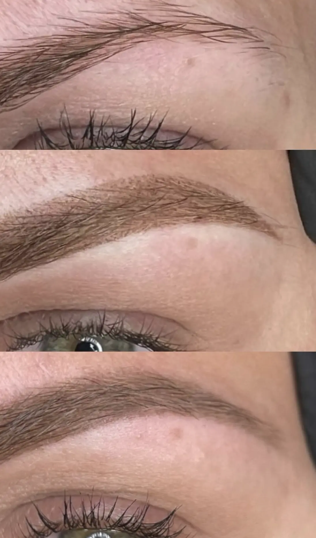 eyebrow tattoo removal perth