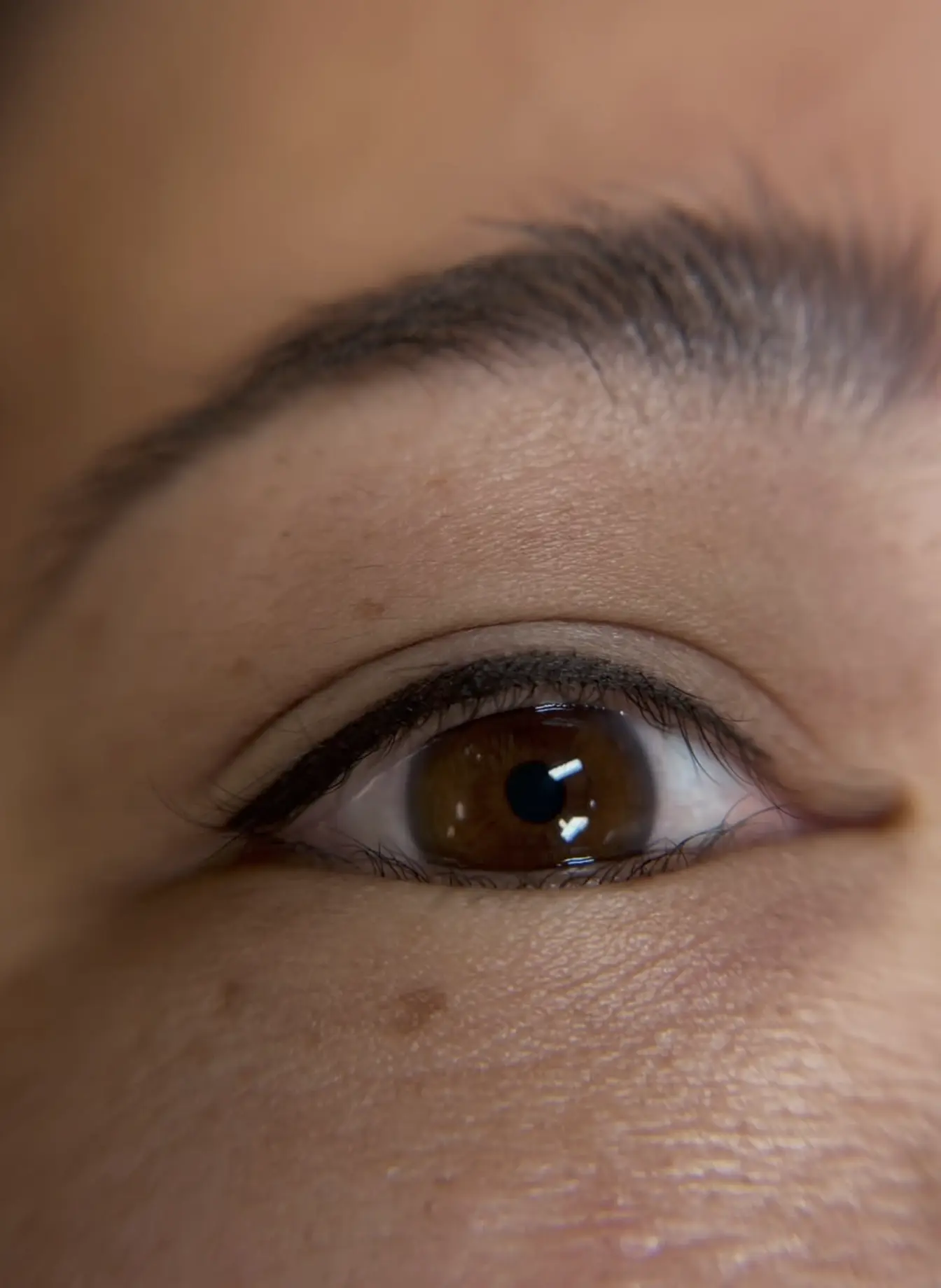 eyeliner tattoo removal