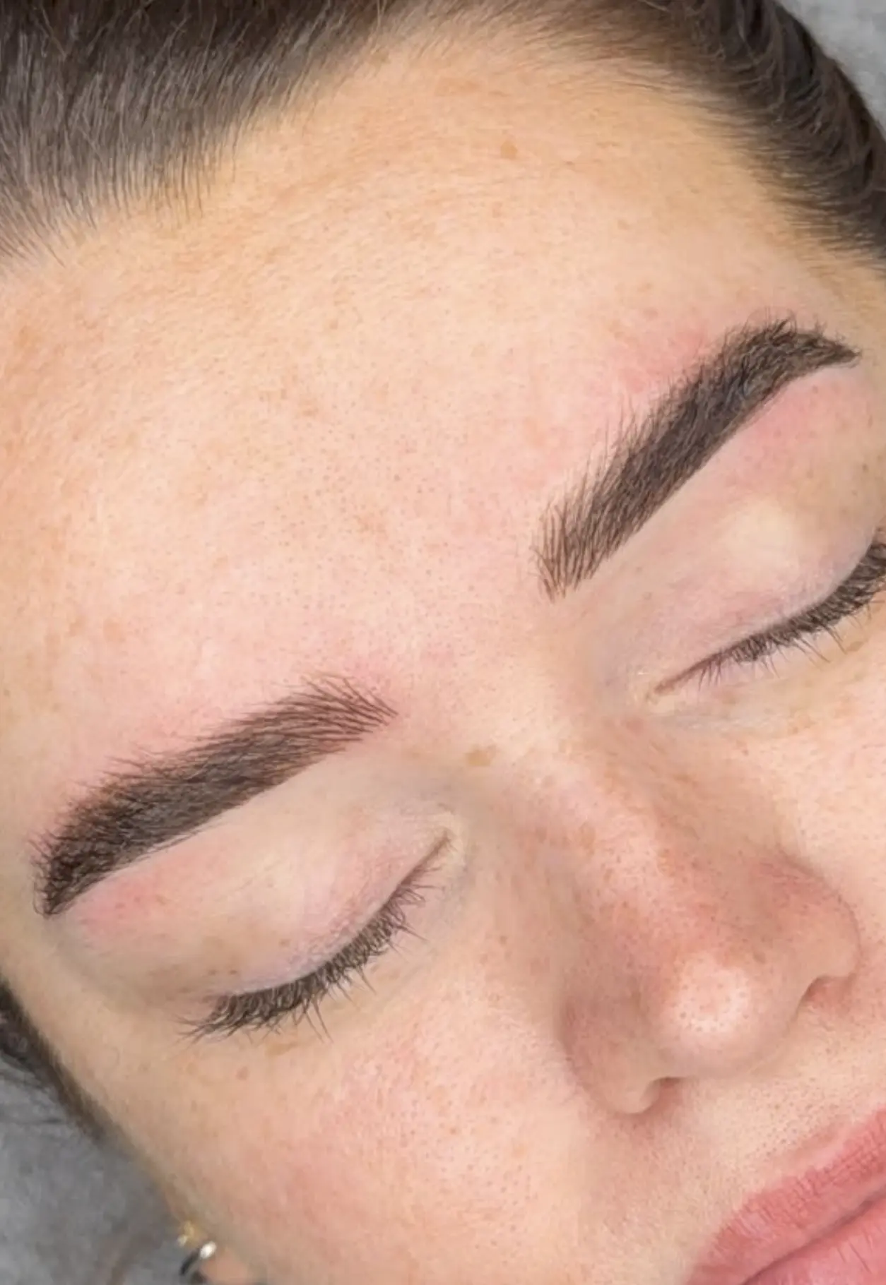 laser eyebrow tattoo removal