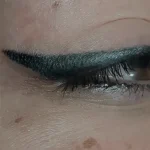 Can An Eyeliner Tattoo Cause Dry Eyes?