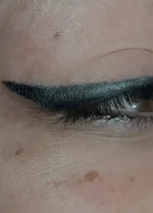 Can An Eyeliner Tattoo Cause Dry Eyes?